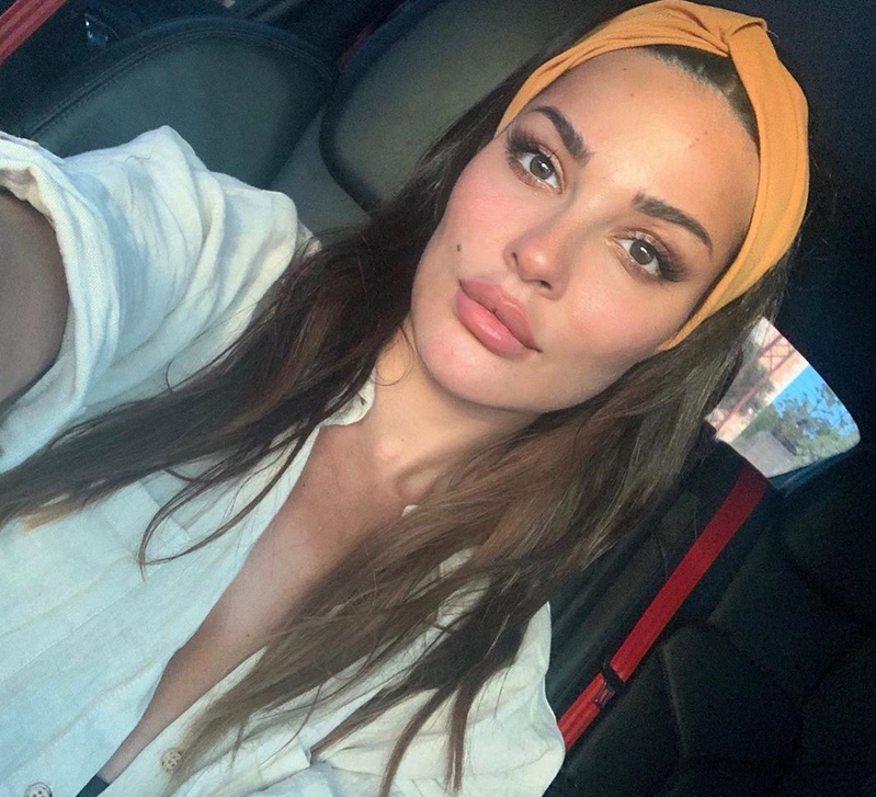 بالصورة – إصابة نادين نسيب نجيم أثناء التصوير والشفاء يتطلب شهراً