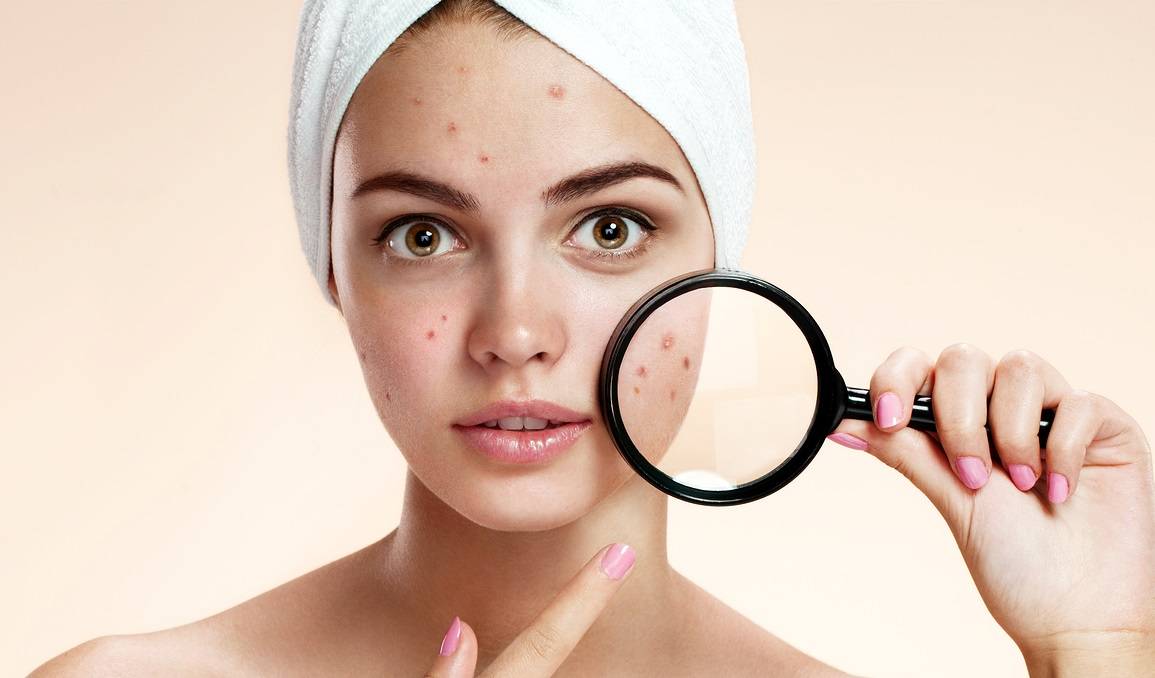 على عكس ما تعتقدين الفلفل الحار صديق بشرتك