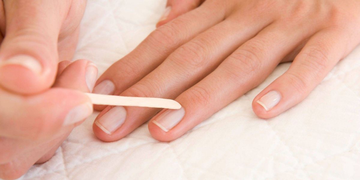 7 طرق طبيعية لتبييض الأظافر