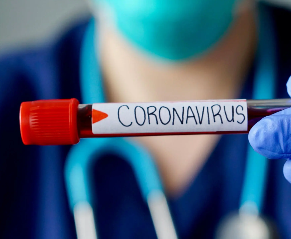 بالصورة - فنان عربي مصاب بكورونا ويرفض الذهاب إلى المستشفى