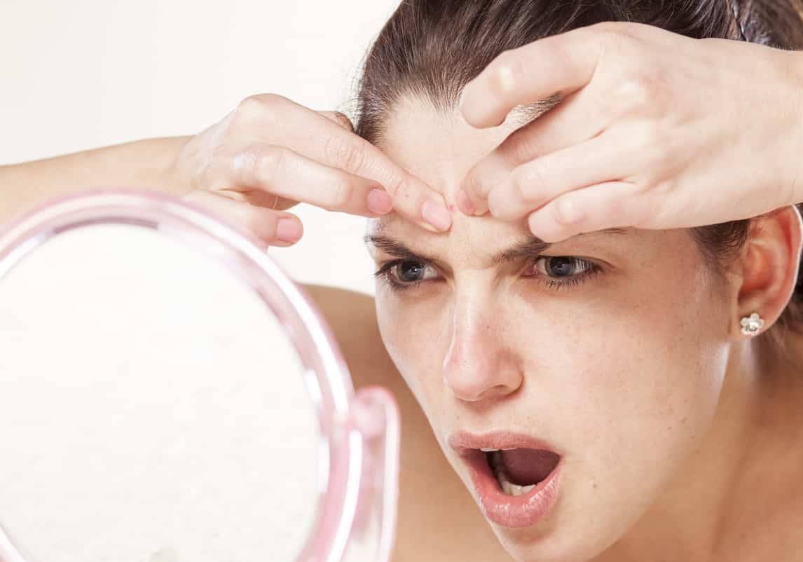 بثور الجبين تنمو لهذا السبب وإليك طريقة إزالتها في المنزل