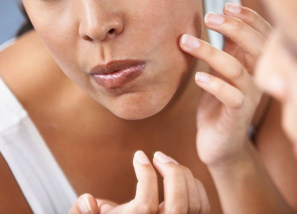 إليك طريقة قشر البرتقال للتخلص من الرؤوس السوداء بسرعة