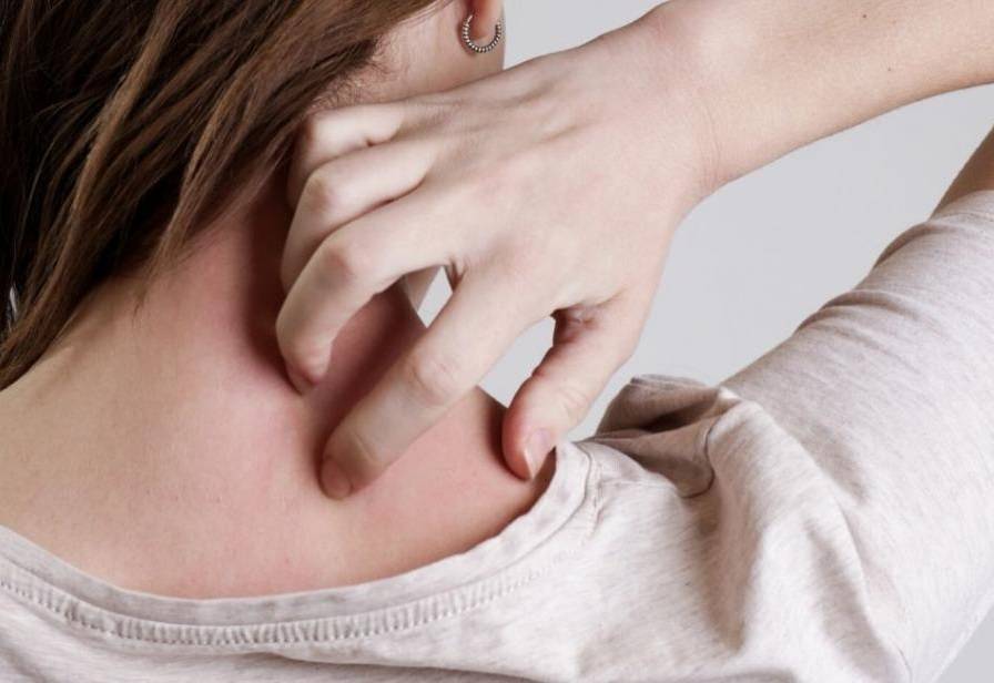 حساسية الحمضيات الغريبة... ماذا تعرفون عنها؟