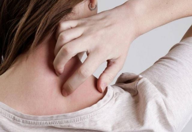 حساسية الحمضيات الغريبة... ماذا تعرفون عنها؟