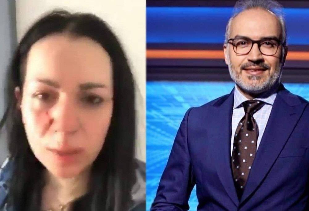 بالفيديو – بعد كشف ضربه لها... زوجة الإعلامي السوري تعلن هذه الحقائق عنه