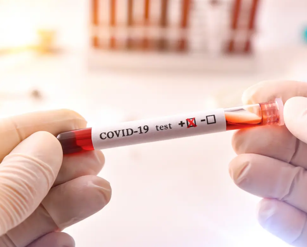 للمرة الأولى متعافٍ من كورونا يُصاب بالعدوى مجدداً