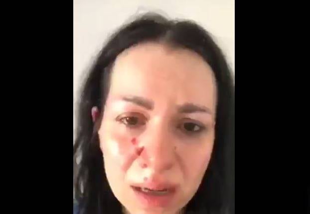 اعلامي سوري يضرب زوجته الحامل.. وهي تشكو معاناتها بفيديو