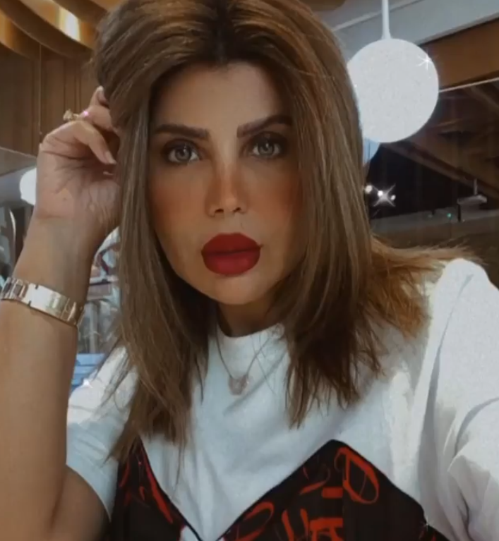 بالفيديو – عمليات التجميل تمنع إلهام الفضالة من قَبول هذا الدور