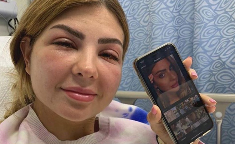 بالصورة – تشوّه جمال مدوّنة عربية شهيرة بسبب تعديل تجميلي