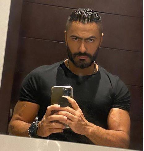 بالفيديو - ما حقيقة خضوع تامر حسني للتجميل؟.. صديقه يوضح