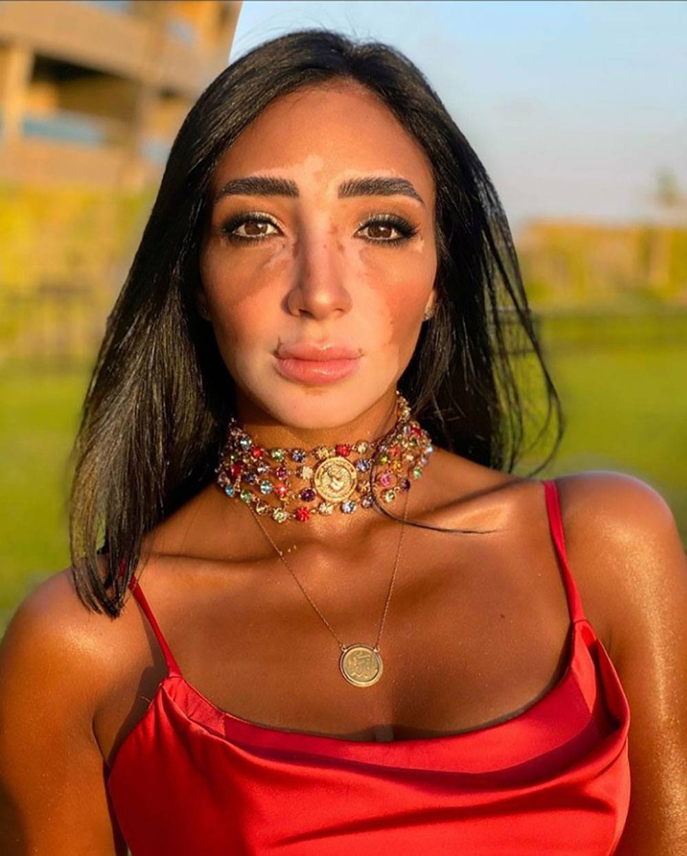 بالفيديو- معاناة بطلة 