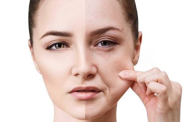 طرق بسيطة لشدّ البشرة المترهلة طبيعياً