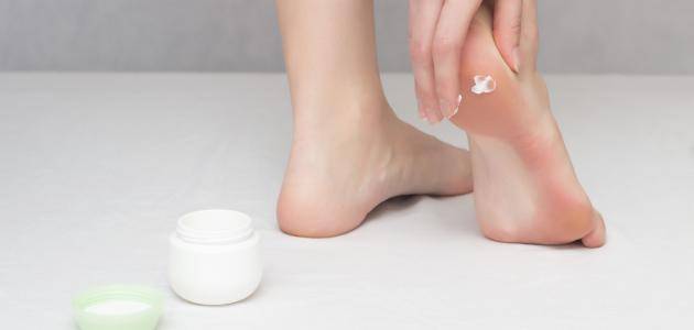 طرق للعناية بتشققات القدمين والتخلص منها