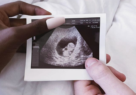 بالصور - نجمة سعودية حامل من زوجها البريطاني