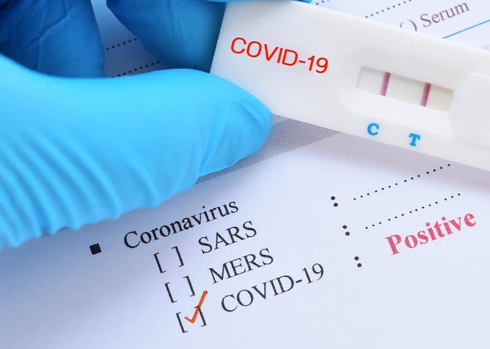 بعد انتهاء مهرجان الجونة... كشف إصابة هذا النجم بكورونا وتحذير للمخالطين