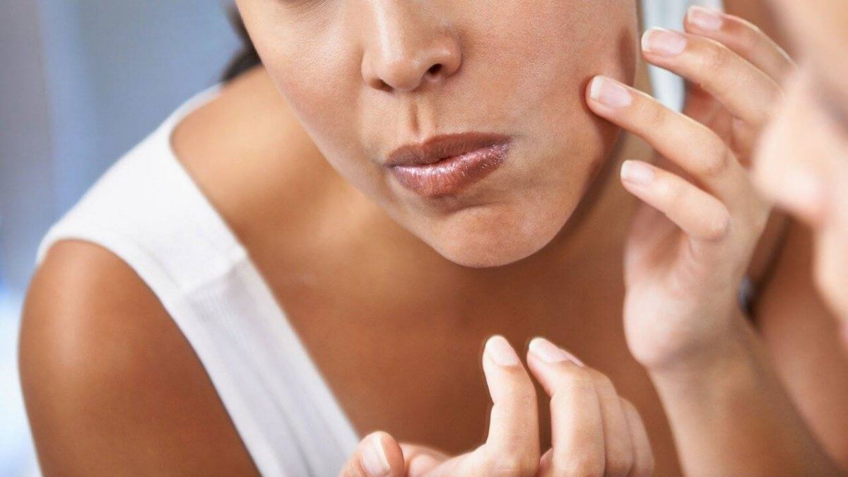 بالملح والليمون فقط تتخلصين من الرؤوس السوداء نهائياً