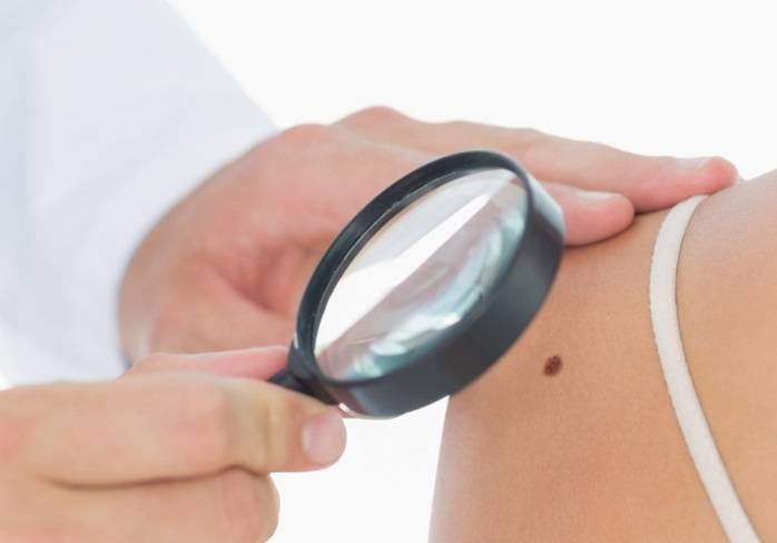 التوصل إلى لقاح يمنع تكرار الإصابة بسرطان الجلد... وهذه التفاصيل