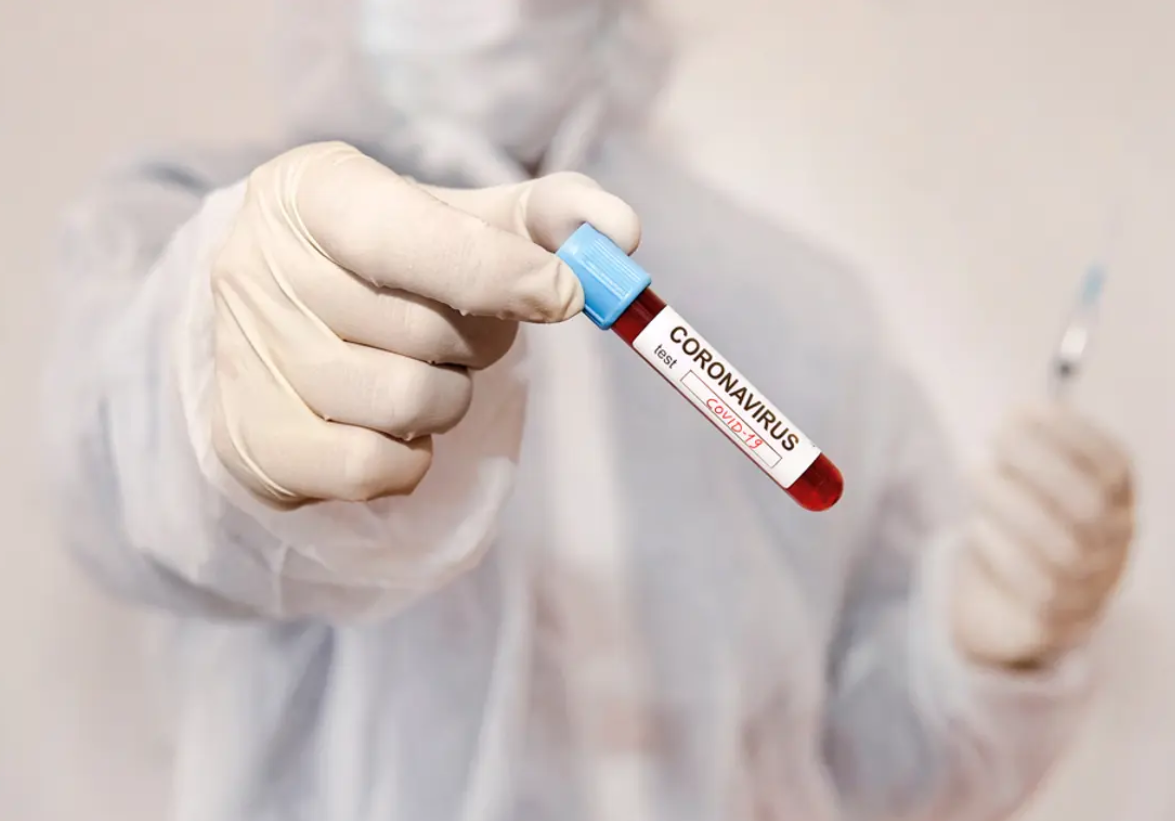 خبراء يعثرون على فيروس مشابه لكوفيد 19 وجد قبل ظهوره في الصين