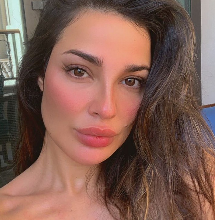 بالفيديو – للمرة الأولى هكذا بدا وجه نادين نسيب نجيم مشوّهاً لحظة إصابتها في انفجار بيروت