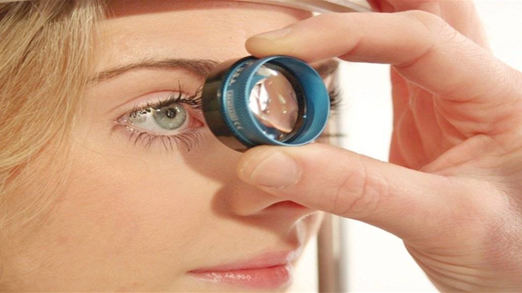 لون العين وسيلة لتشخيص بعض الأمراض