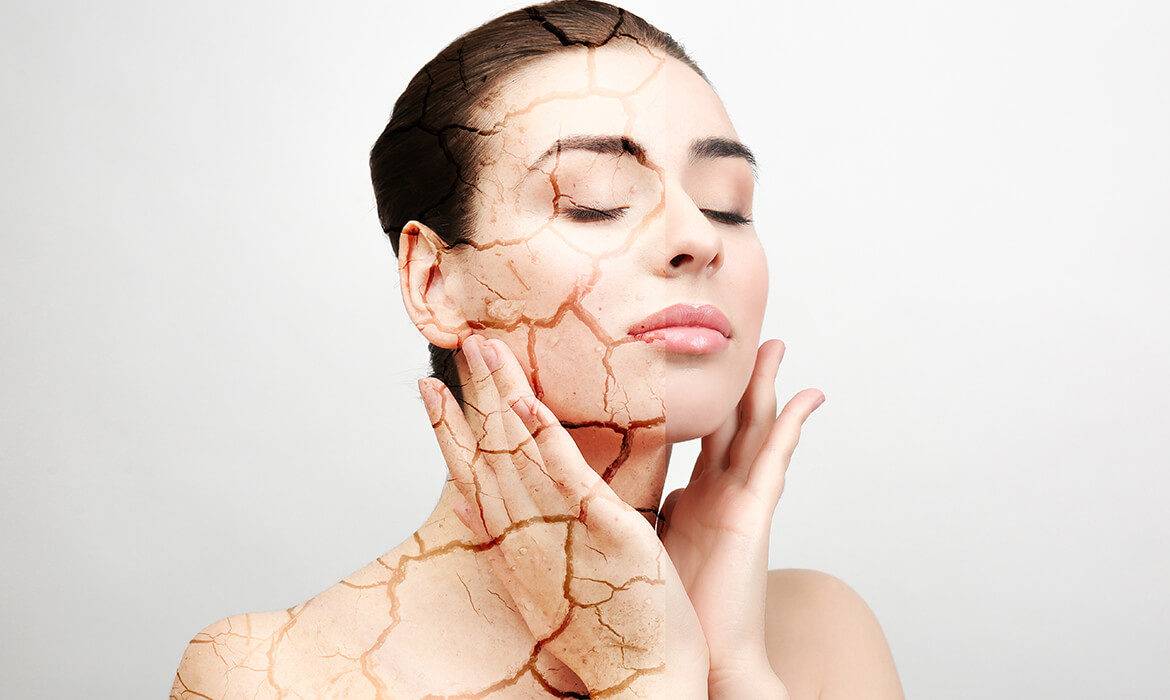 هل تعرفين أن هذه الأصناف تسبّب جفاف بشرتك في الشتاء؟