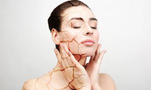 هل تعرفين أن هذه الأصناف تسبّب جفاف بشرتك في الشتاء؟