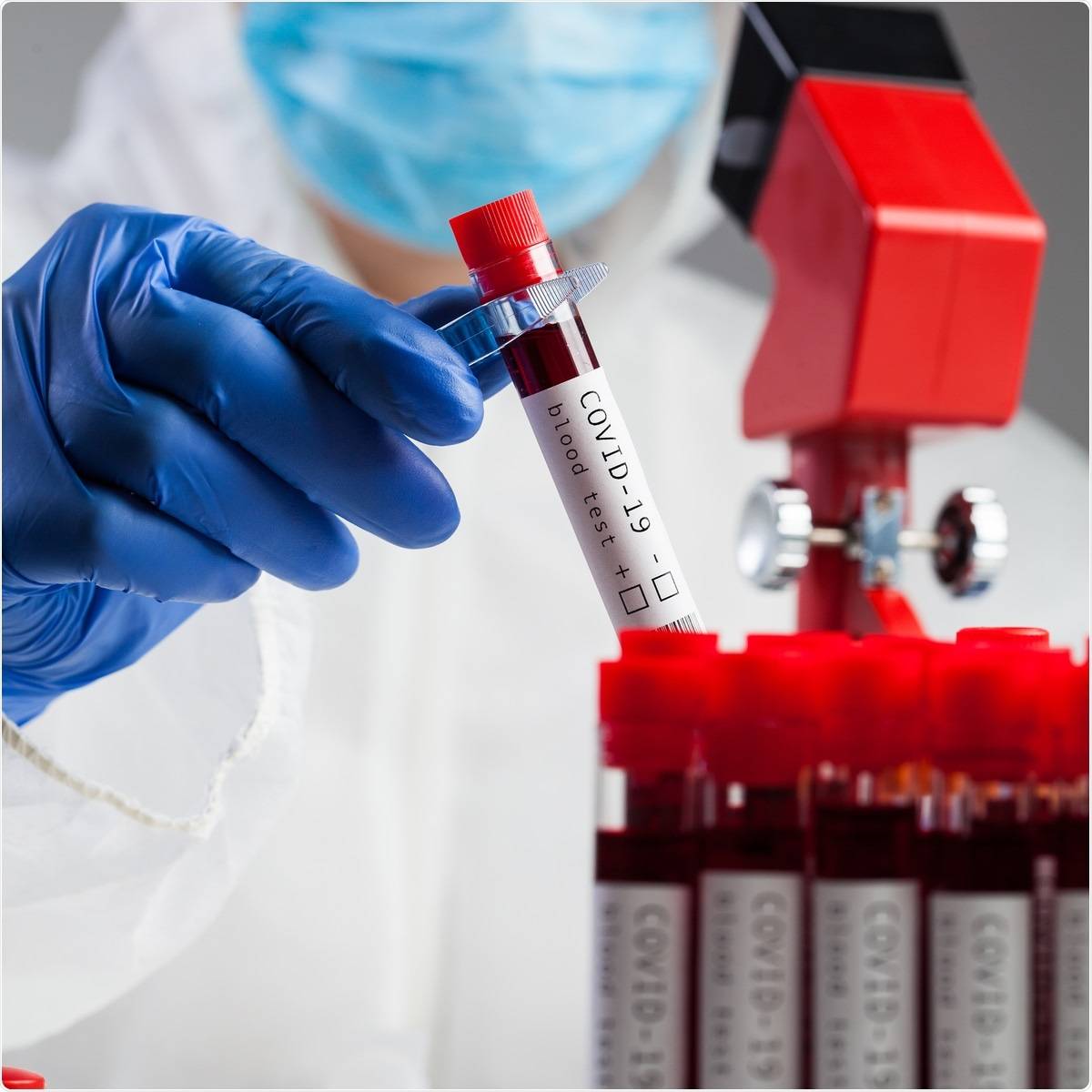 دراسة مفاجئة – بلازما دم المتعافين لا تساعد مرضى كورونا