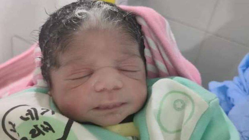 في حالة نادرة... طفلة تولد بخصلات شعر بيضاء