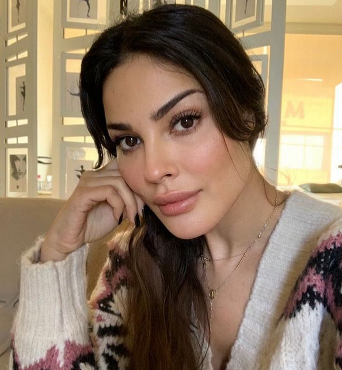 بالصور – بعد أشهر من الإصابة... نادين نسيب نجيم تكشف شكل وجهها من دون مكياج