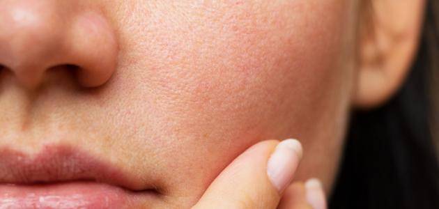 علاج سريع للبشرة الجافة في كل الفصول