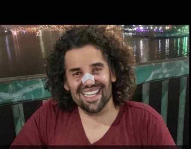 بالصور - ما حقيقة خضوع حسين الجسمي لعمليات تجميلية