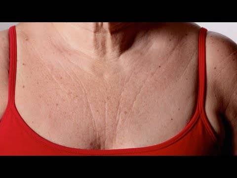 نصائح بسيطة لتجنّب ظهور التجاعيد عند منطقة الصدر