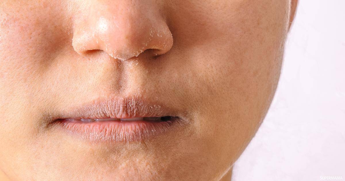 عادات خاطئة قد تتسبّب في جفاف البشرة