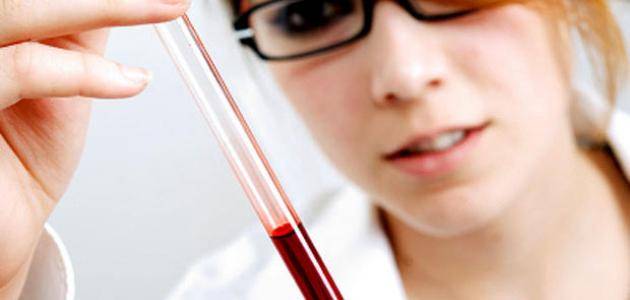 علامة خفية على الأصابع تُنذر بارتفاع معدل الكوليسترول