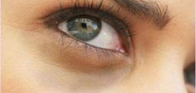 طريقتان بسيطتان في المنزل لإزالة السواد تحت العينين