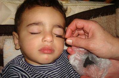 هل يسبّب تكحيل الطفل عند الولادة أي ضرر؟ هذا ما يكشفه الطب