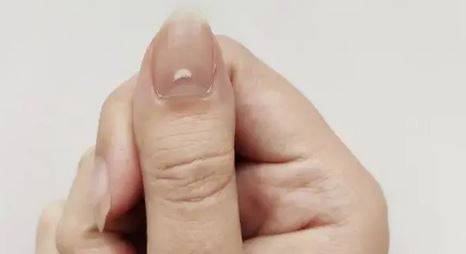 احذروا من تغيّر مظهر الأظافر بعد الإصابة بكورونا