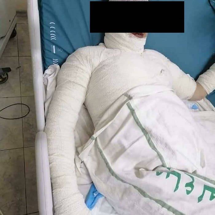 جريمة مروّعة في بلد عربي... حرقها أمام أولادها!