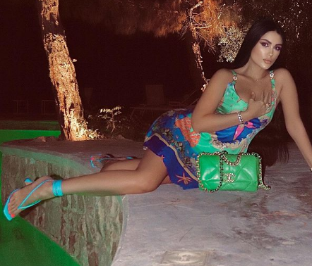 شيرين ابو العز تكشف الكدمات التي تسببّ بها شجار عمر طارق العريان