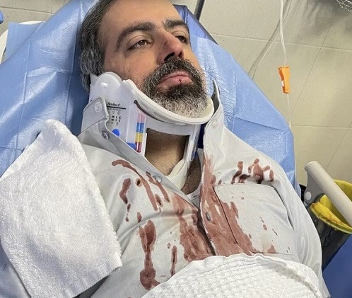 الكشف عن وضع عبدالله التركماني بعد حادث سير مروّع