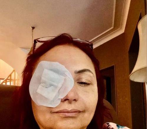 إصابة المخرجة هالة خليل في عينها.. وتعلق: 