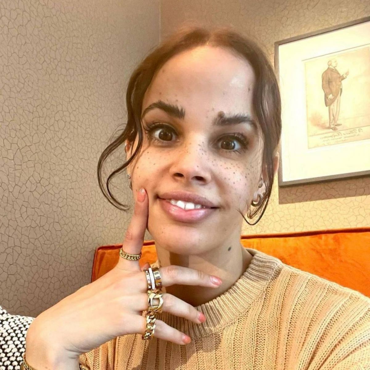 بعد جنى... نور عمرو دياب تعلن إصابتها بمرض فرط الحركة