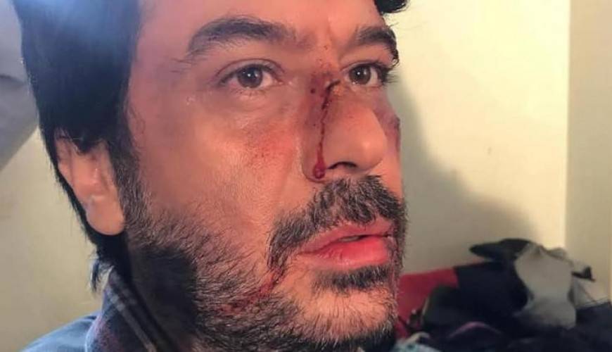 حقيقة تعرّض ميلاد يوسف للضرب المبرّح على يد 4 شبان