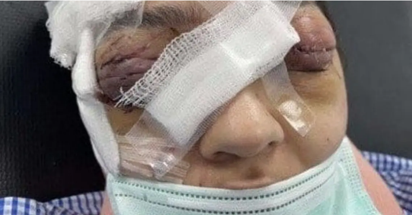 توقيف زوج اعتدى بالضرب بوحشية على زوجته في جدة