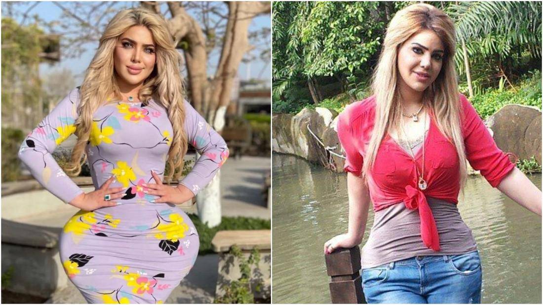 مروة راتب تخضع لعملية نحت جديدة