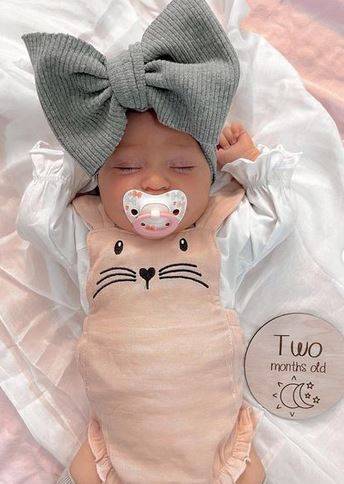 بالصور - طفلة جميلة محط اهتمام الجميع بسبب مرضها النادر