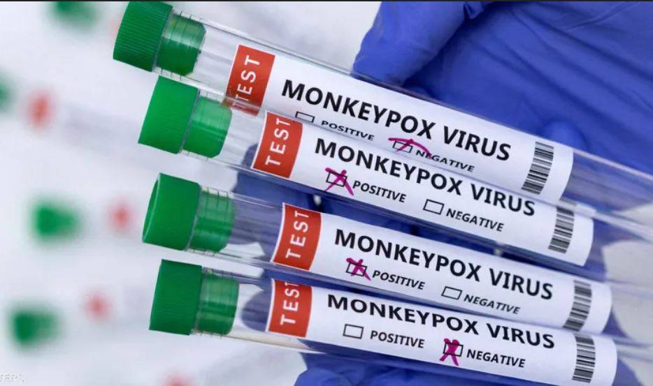 توصيات طبية ضرورية للحدّ من إنتشار جدري القرود