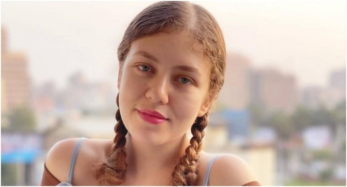 رحمة حسن تكشف تطورات حالتها الصحية بعد عضة الكلب