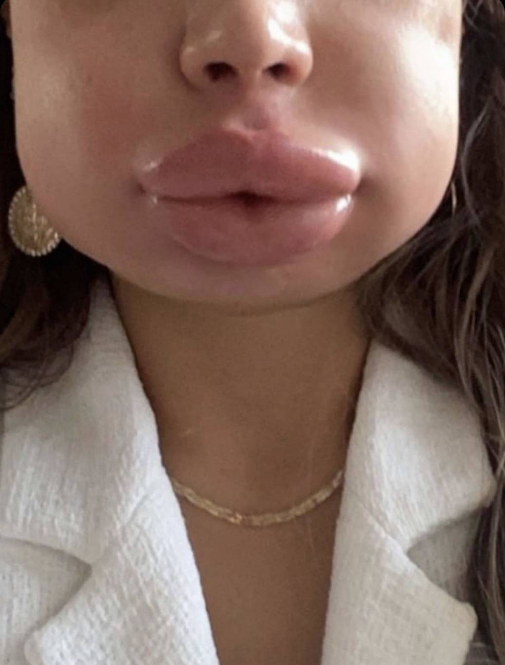 بالفيديو - فنانة مصرية توضح سبب إصابتها بتشوّه في وجهها