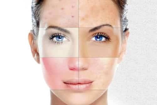 أطعمة تضرّ بالبشرة وتُسرّع علامات الشيخوخة... تجنّبوها